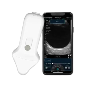 B-Scan Ultrasound Wireless System